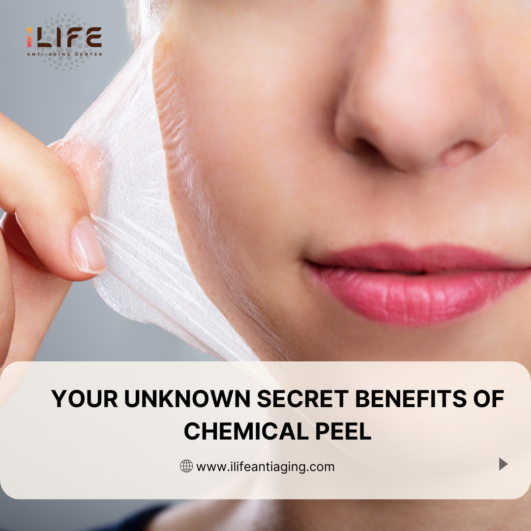 Your Unknown Secret Benefits of chemical peel
