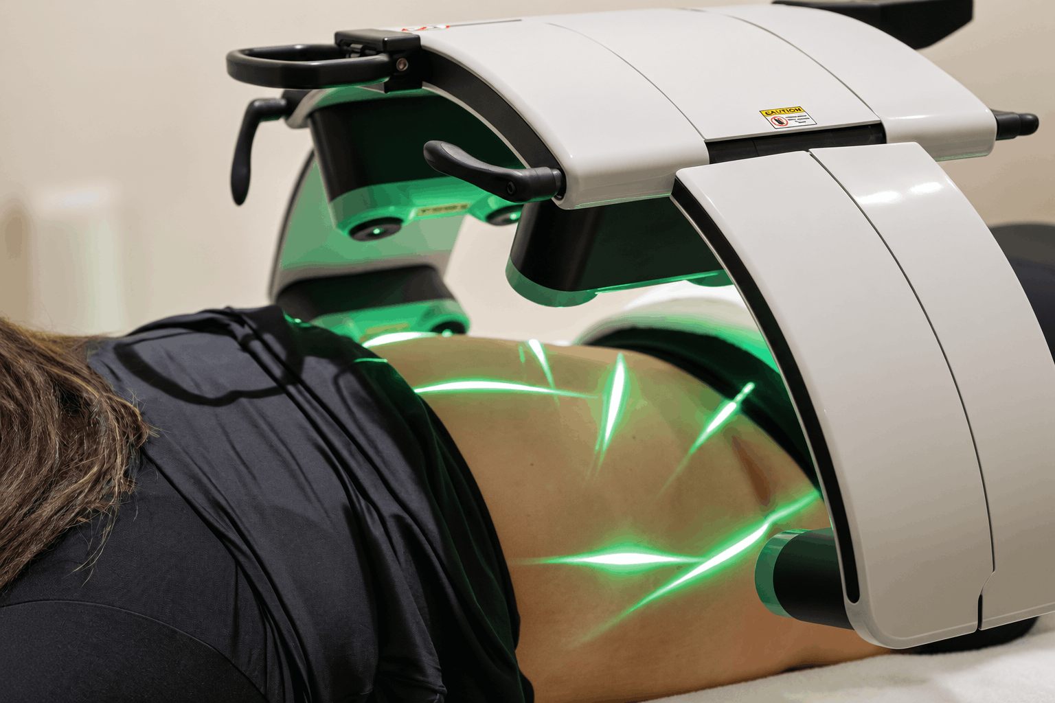 Is Green Light Laser Therapy Effective for Fat Loss?